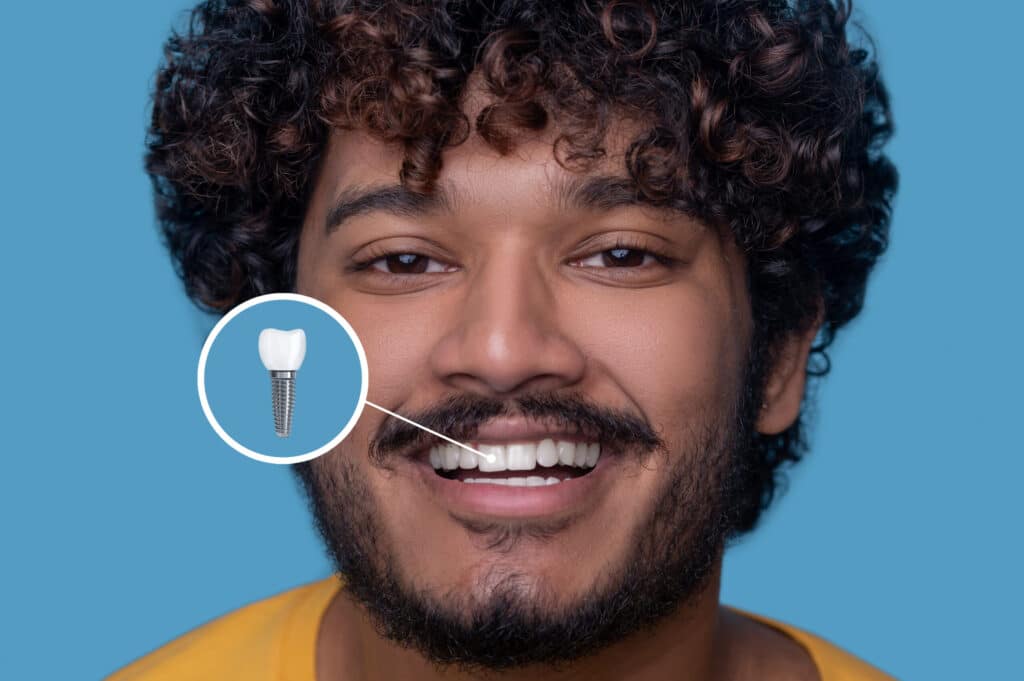 Man smiling showing dental implant with callout diagram in Niceville, FL.