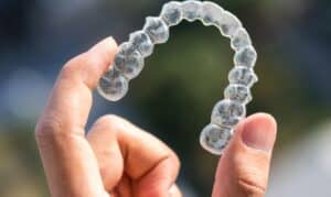 Clear Invisalign aligner held between fingers, showing transparent plastic tray with multiple aligners.