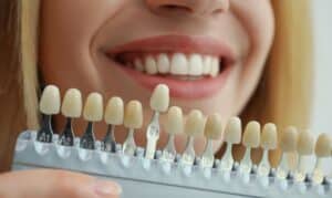 Woman holding a dental shade guide showing tooth color options for cosmetic dentistry treatment.