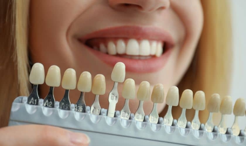 Woman holding a dental shade guide showing tooth color options for cosmetic dentistry treatment.
