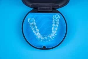 Clear aligner case displaying transparent dental aligners with attachments for front teeth correction.