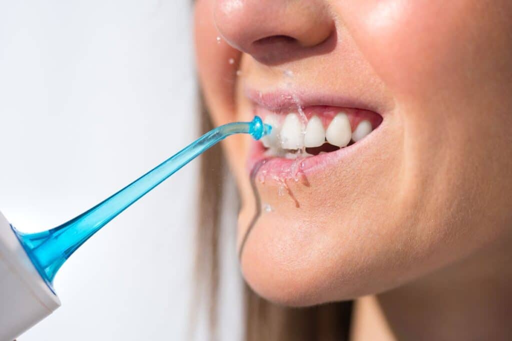 Patient using a blue water flosser to clean teeth and gums after dental bonding.