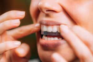 Person applying a teeth whitening strip to upper teeth.