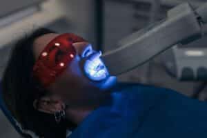 Patient receiving professional teeth whitening treatment with blue LED light activation.