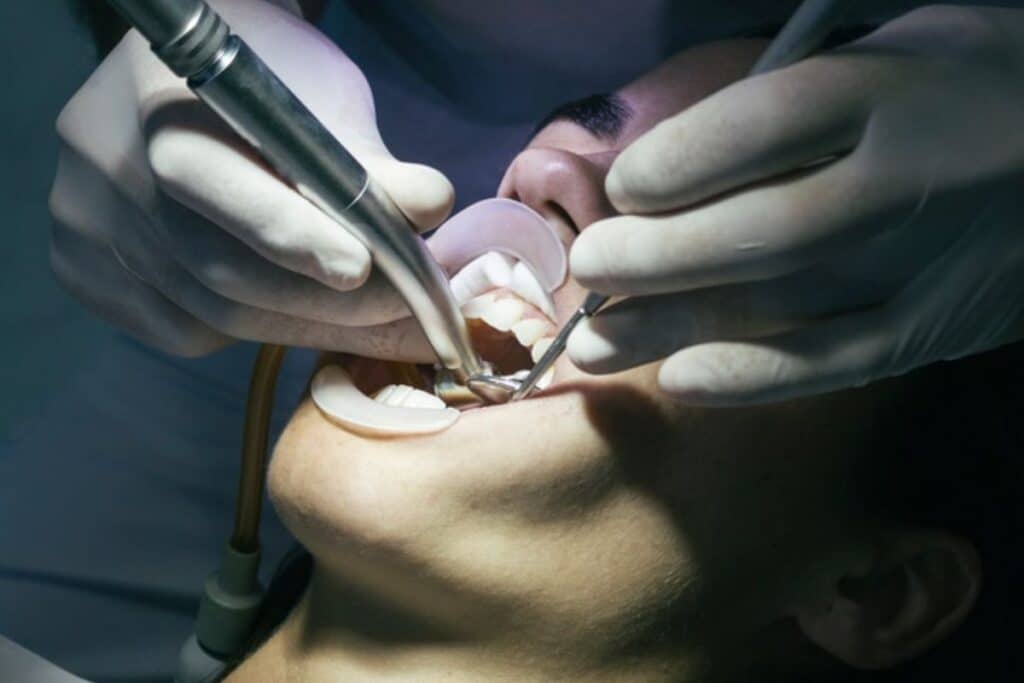 Dentist performing professional teeth cleaning with ultrasonic scaler on patient.