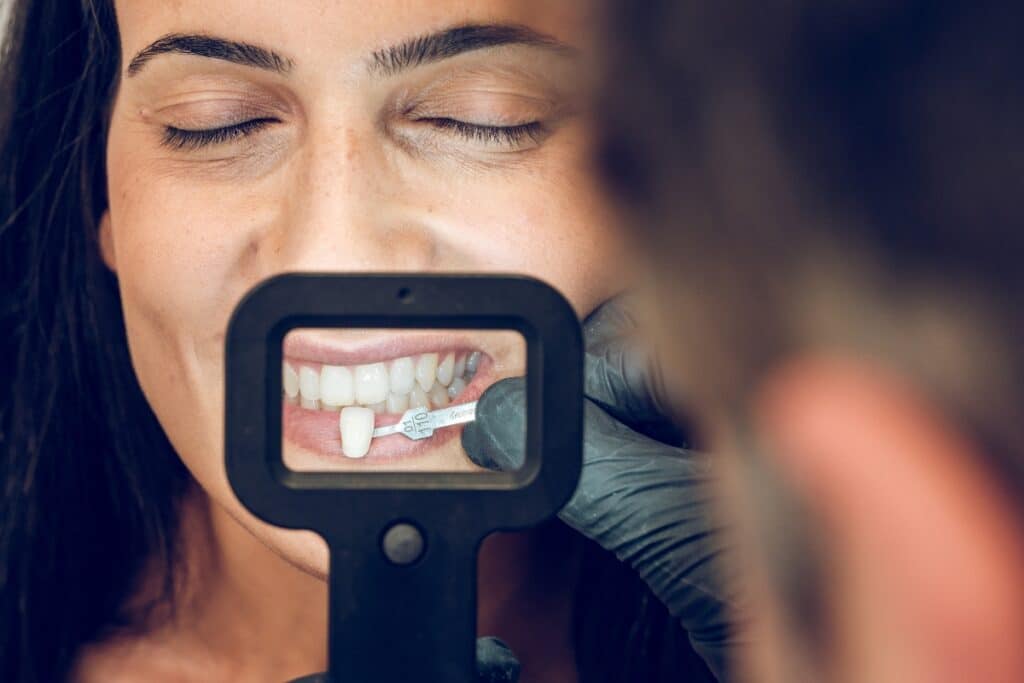 Dentist examining patient's tooth shade with porcelain veneer shade guide during cosmetic consultation.