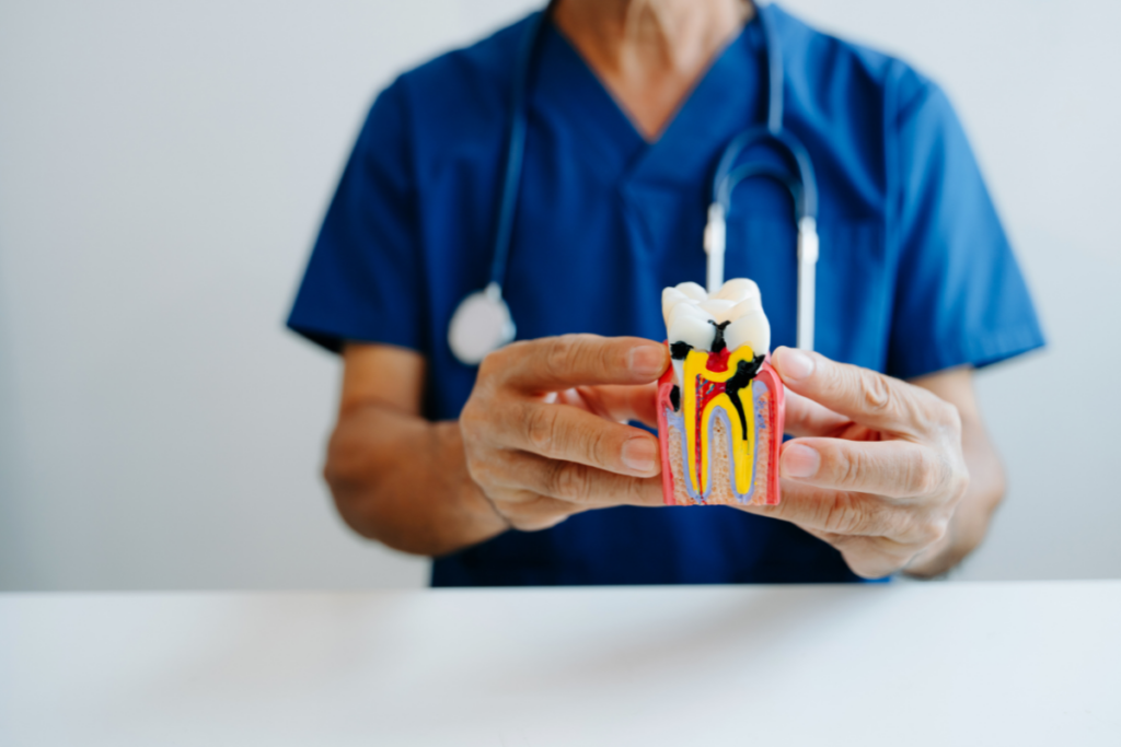 Dentist holding a tooth anatomy model showing internal dental structures and decay.